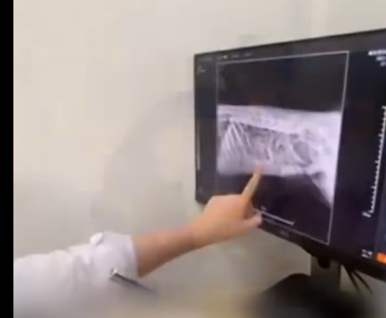 T1905020 true story about rescued dog found in dumpster part2