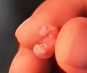 Part2 Animals Rescue #dogrescue #rescuedog #dogsofttiktok #foryoupage #foryou #dogs