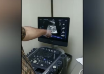 Rescue Poor Dog Suffered Pain Big Tumor In_part2